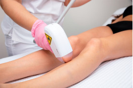 Laser hair removal with a diode laser: an effective solution for smooth