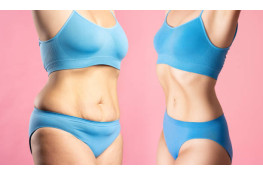 Non-surgical methods of tummy tuck